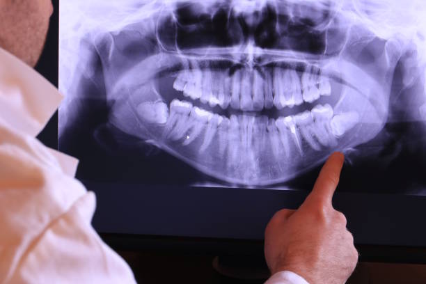 Best Emergency Gum Treatment in Belton, TX
