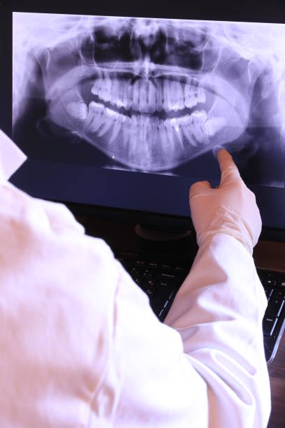Best Emergency Root Canal Treatment in Belton, TX